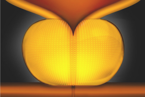 urolift how1